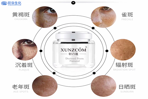 臉上長(cháng)斑原因及祛斑該用的產(chǎn)品-歐泉生化